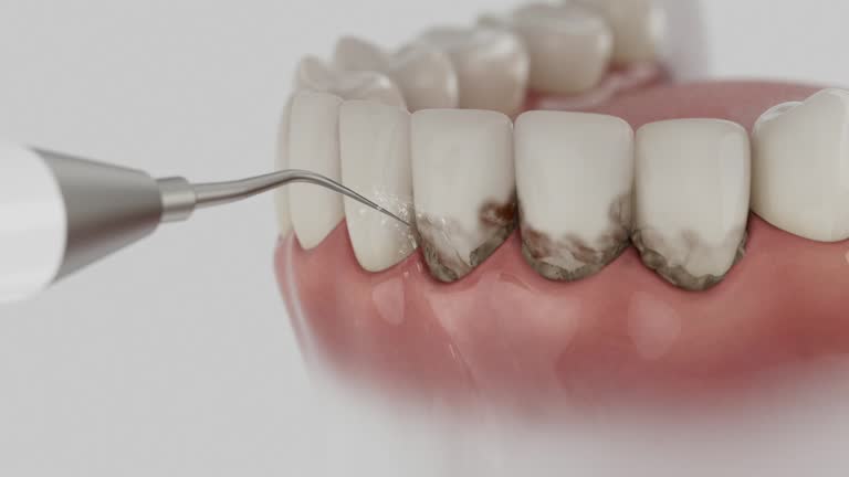 Reliable Dental contractor in Vandalia, OH by Dentist Open Now
